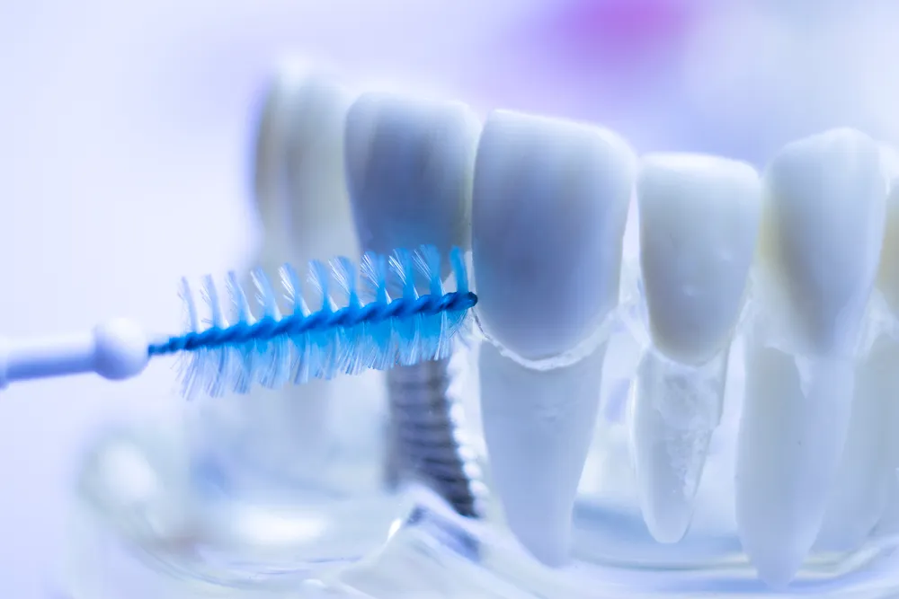 Los beneficios de los cepillos interdentales para los dientes