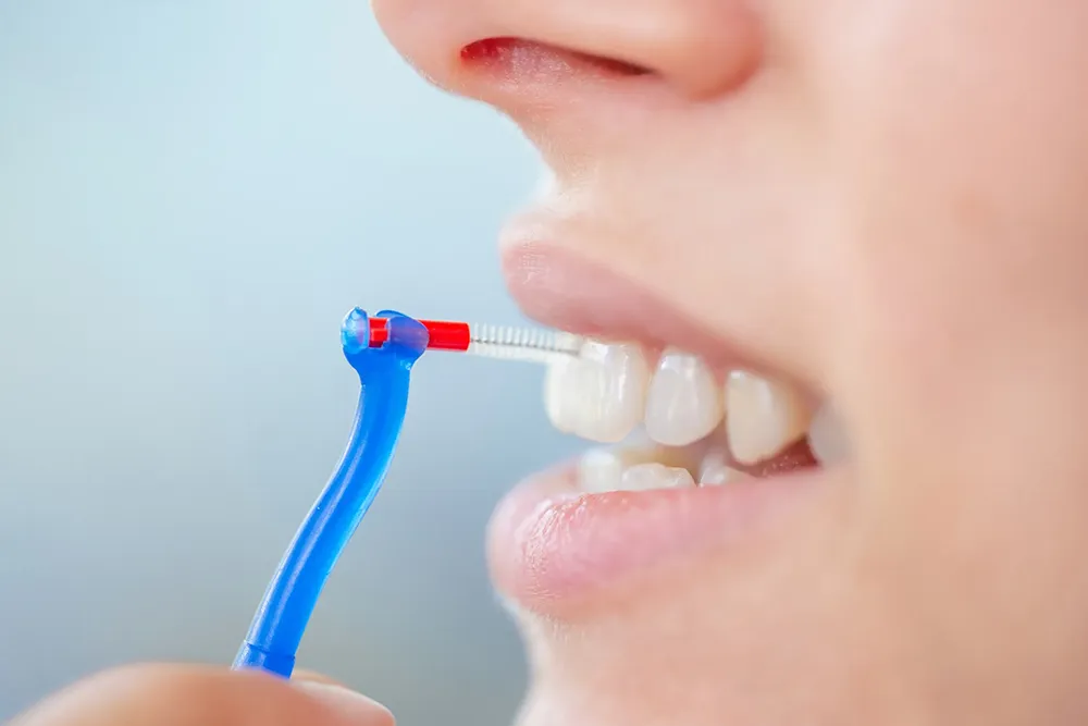 La forma correcta de utilizar un cepillo interdental